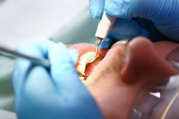 Best Weekend Emergency Dental Services in Ata, OK