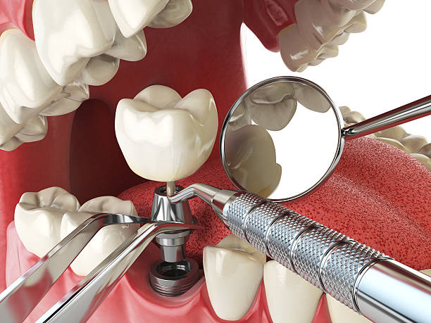 Best Emergency Denture Repair in Ata, OK
